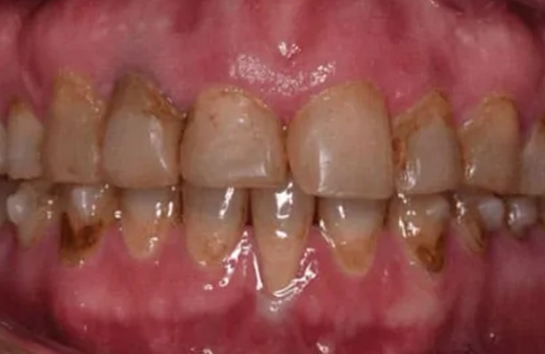 1 Before |Dentist North Shore