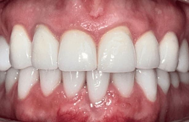 2 After |Dentist North Shore