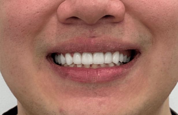 3 After |Dentist North Shore