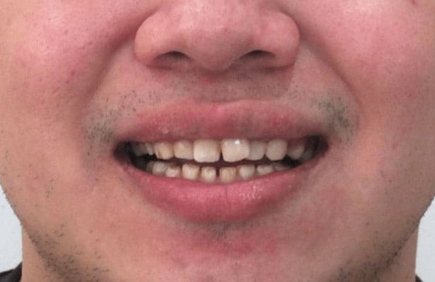 3 Before |Dentist North Shore