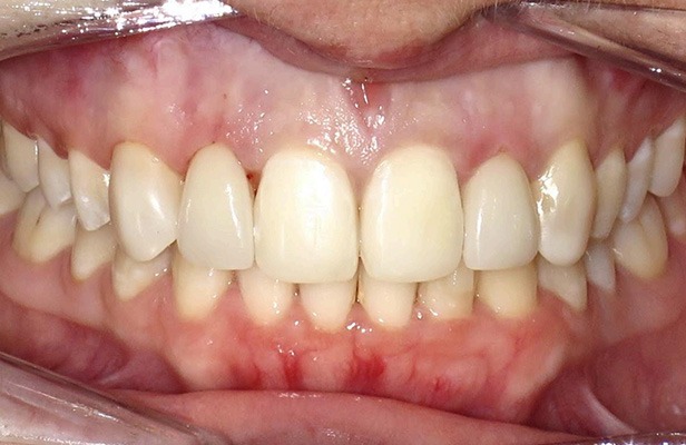 G Photo 10a |Family dentist Artarmon