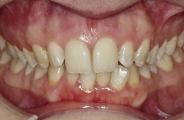 G Photo 10b | Family dentist Artarmon