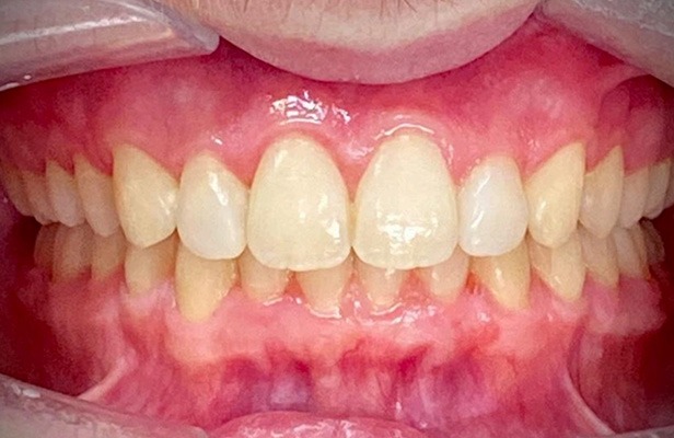 G Photo 12a | Family dentist Artarmon