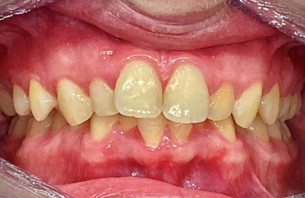 G Photo 12b | Family dentist Artarmon