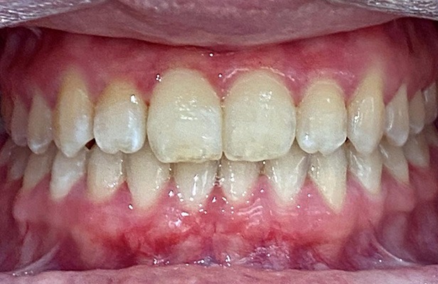 G Photo 13a | Family dentist Artarmon