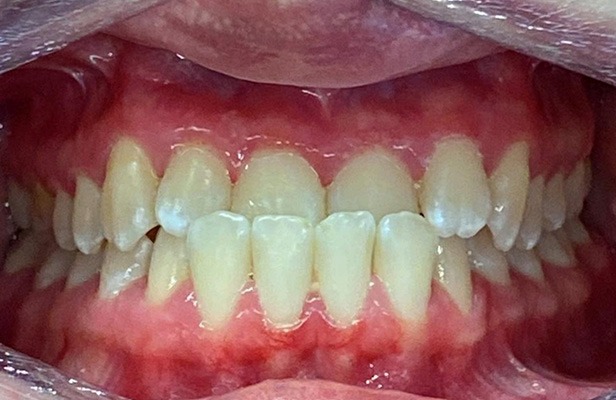 G Photo 13b | Family dentist Artarmon