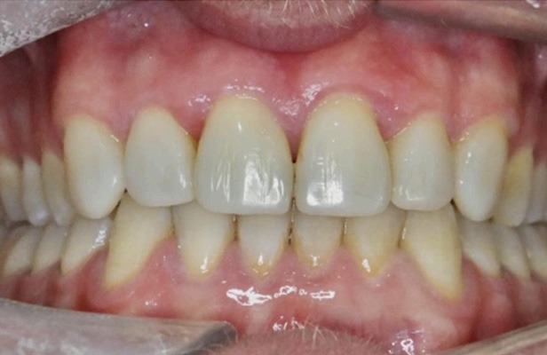 G Photo 14a | Family dentist Artarmon