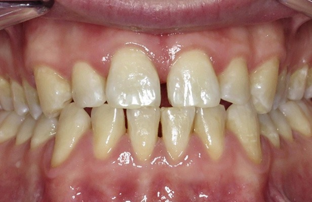 G Photo 14b | Family dentist Artarmon