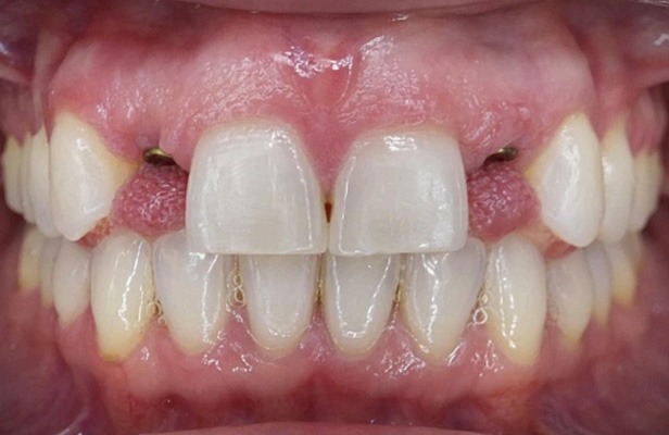 G Photo 15a |Family dentist Artarmon