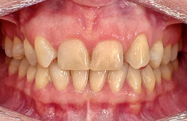 G Photo 15b |Family dentist Artarmon