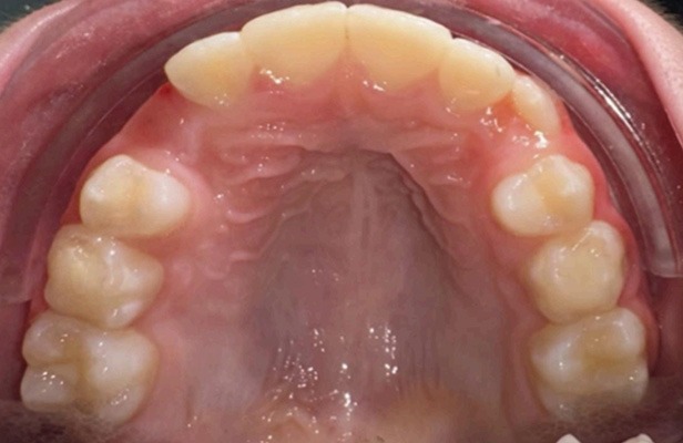 G Photo 17a | Family dentist Artarmon