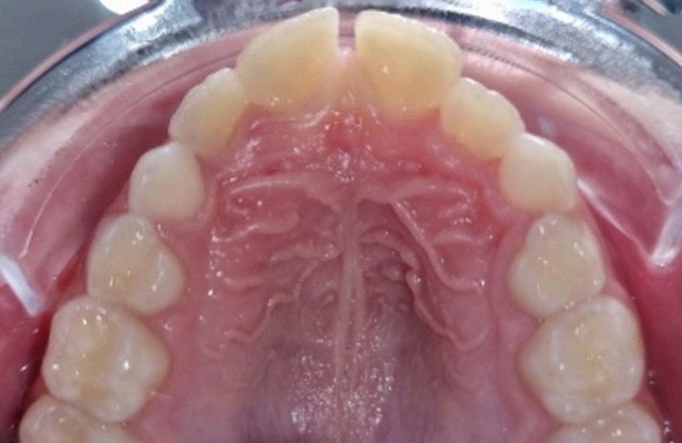 G Photo 17b | Family dentist Artarmon