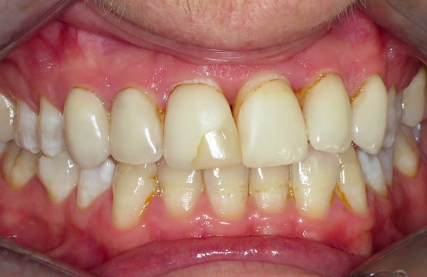 G Photo 2b|Family dentist Artarmon