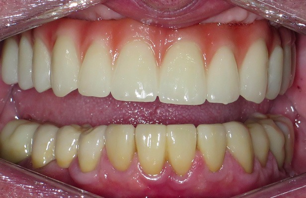 G Photo 3a |Family dentist Artarmon