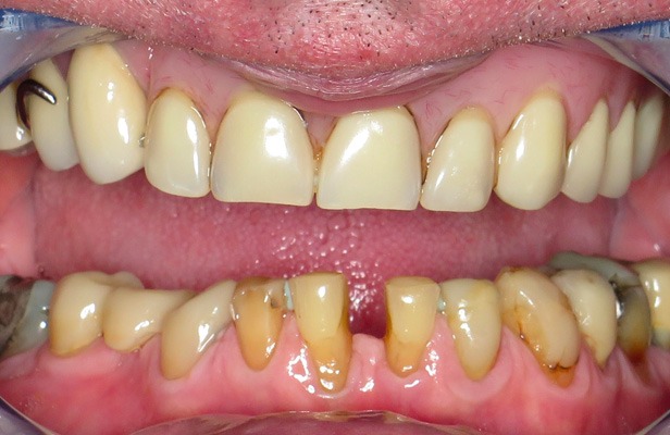 G Photo 3b |Family dentist Artarmon