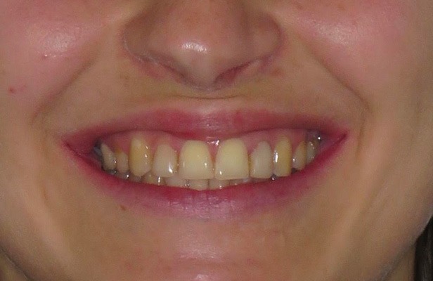 G Photo 4b |Family dentist Artarmon