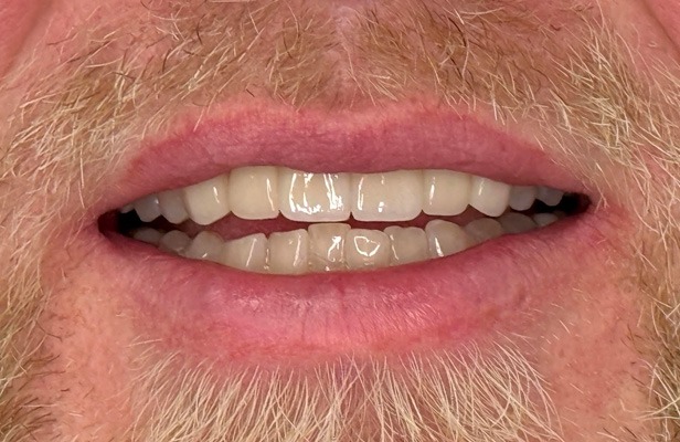 G Photo 7a | Family dentist Artarmon