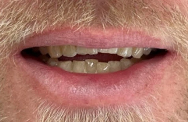 G Photo 7b |Family dentist Artarmon