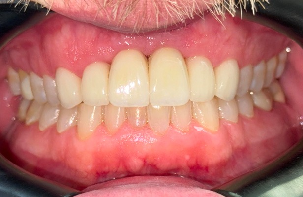 G Photo 8a | Family dentist Artarmon