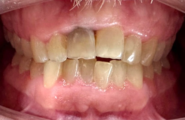 G Photo 8b |Family dentist Artarmon