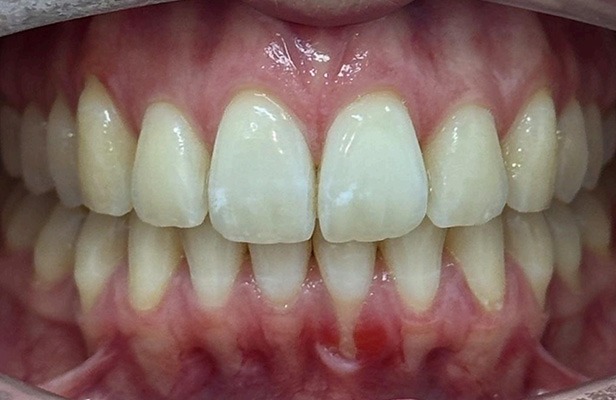 G Photo 9a | Family dentist Artarmon