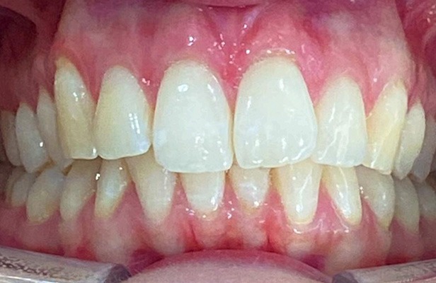 G Photo 9b | Family dentist Artarmon